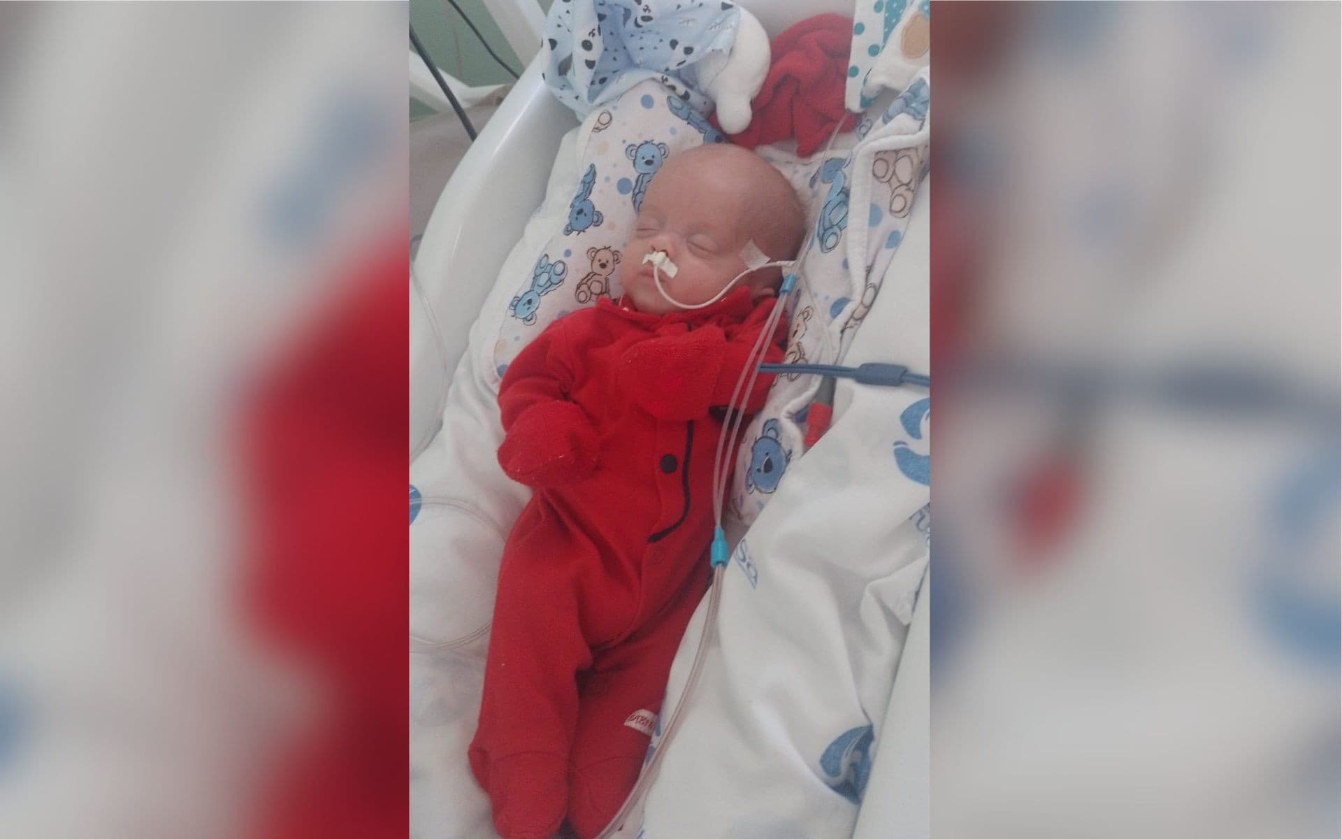 Menino prematuro de 3 anos enfrenta escoliose progressiva
